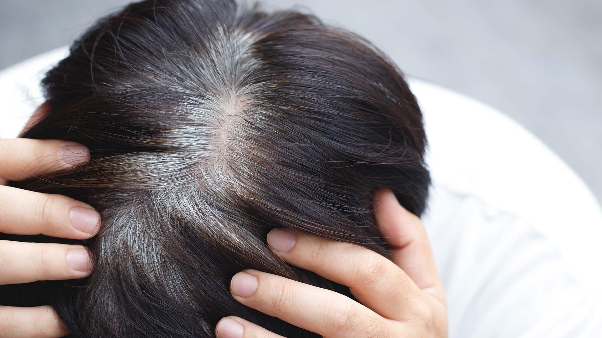 هۆکارێکی سپیبوونی پێشوەختەی قژ ئاشکرا دەکرێت
